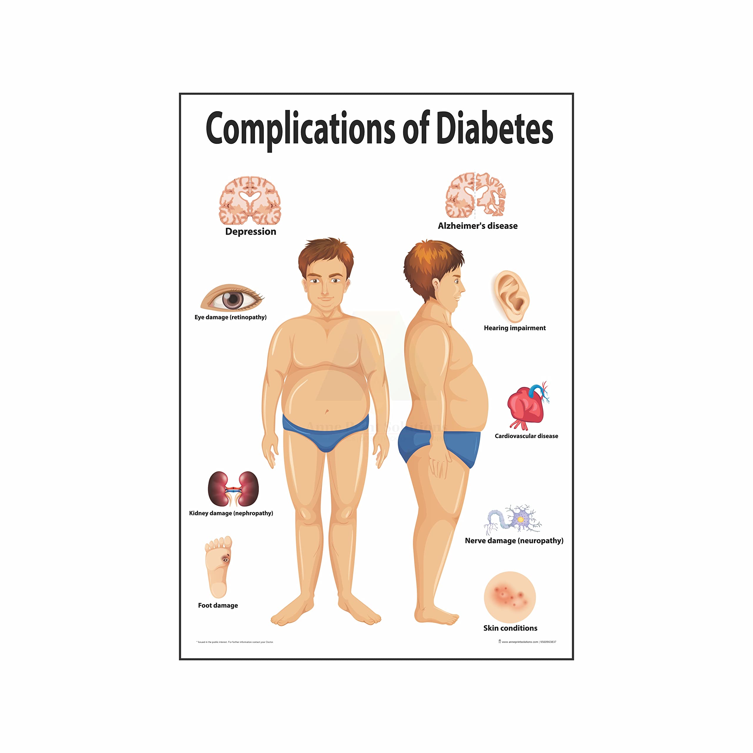 Anne Print Solutions® Complications of diabetes chart Posters For Hospital Posters | Nursing Home Posters | Clinic Posters Pack Of 1 Pcs Size 13 Inch X 19 Inch* Multicolor (OPTION 2) (B0B5XZ3MY5) Amazon Price History, Amazon Price Tracker