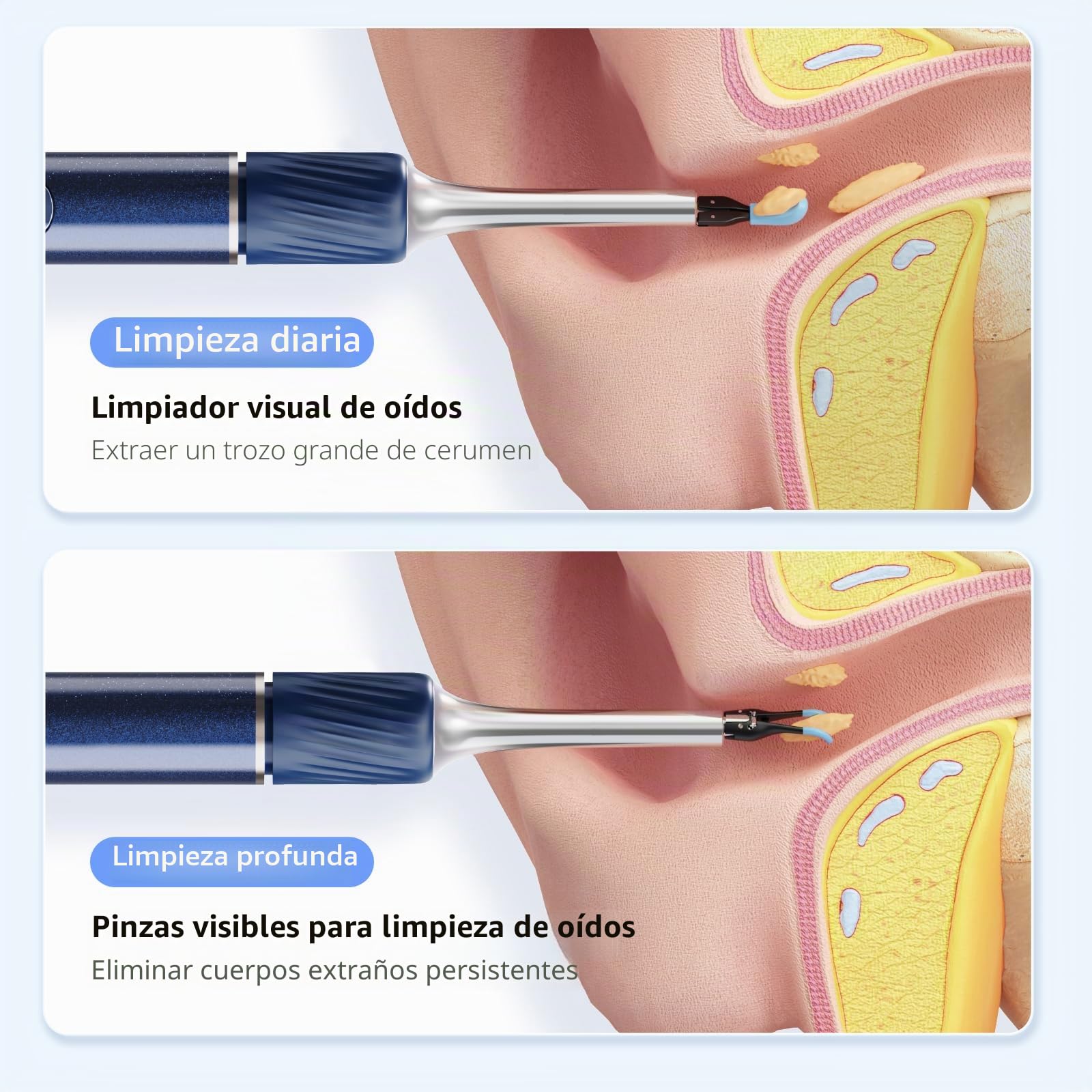 Otoscopio 1080P HD Limpia Oidos IP67 Cámara de Oído Impermeable Limpieza de Oídos con pinzas 4 LED Limpiador de Oidos Cera con Camara Adecuado Para y iOS y Android Ear Wax Remover Camera