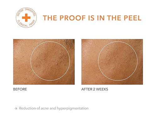 Miniatura 7 de Dr Dennis Gross Alpha Beta Universal Daily Peel para tono o textura desigual y líneas finas o poros agrandados, (5 tratamientos)