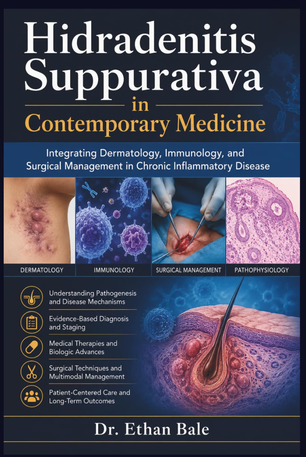 Hidradenitis Suppurativa in Contemporary Medicine: Integrating Dermatology, Immunology, and Surgical Management in Chronic Inflammatory Disease