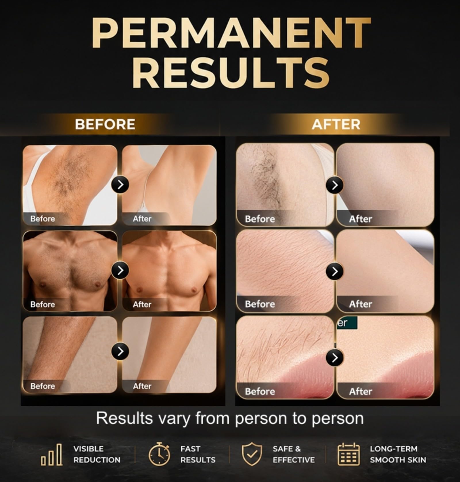 Dispositivo professionale per la depilazione indolore | Adatto per viso, ascelle, gambe, barba e zona bikini