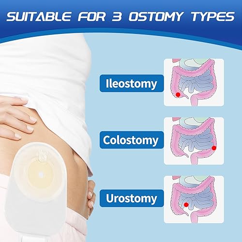 Miniatura 6 de CELECARE Bolsas de colostomía 20 piezas, bolsas de ostomía de una pieza, suministros de ostomía para ileostomía, colostomía, equipado con