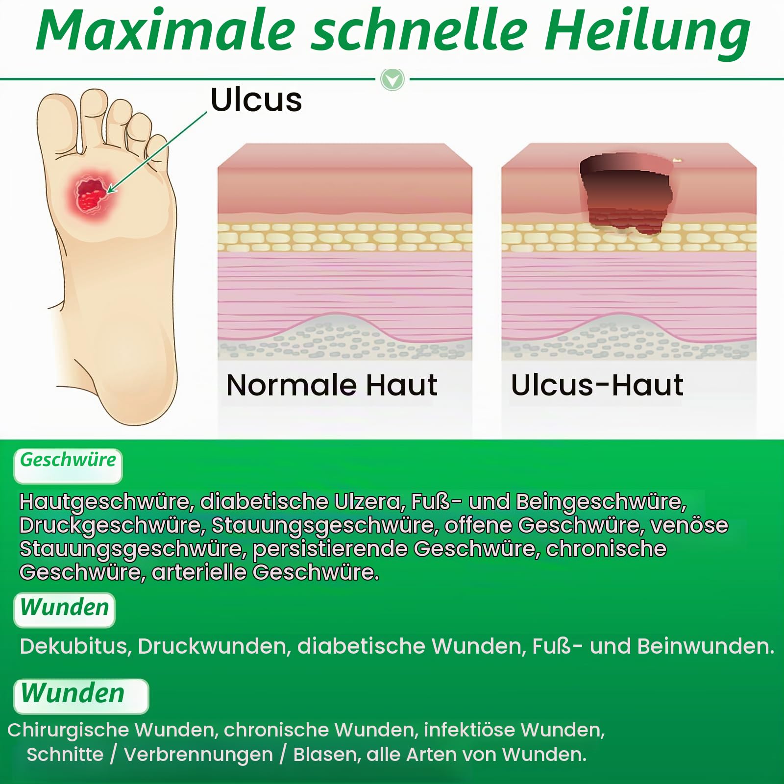 Skin Ulcer Ointment – Promotes Healing of Foot & Leg Ulcers, Bedsores, Varicose/Stasis Ulcers, Cuts, Burns & Infected Wounds
