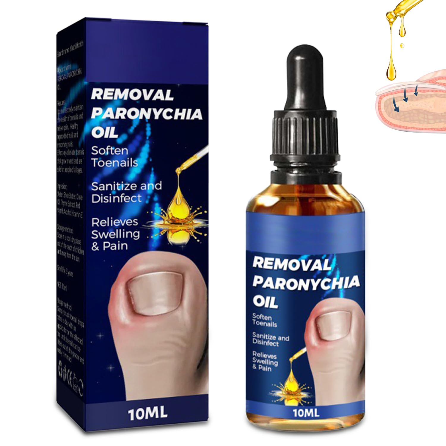 Ingrown Toenail Treatment Extra Strength, Toe Nail Softener, Ingrown Nail Treatment Oil, Supports Nail Growth