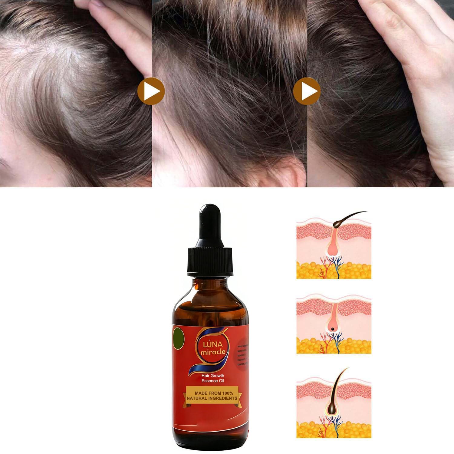 Luna Miracle Hair Growth Oil, Hair Growth Serum, Natural Hair Density Essential Oil, Strengthening Oil Infused Frizzy & Damaged Hair Care to Support Longer, Healthier Strands (2pcs)