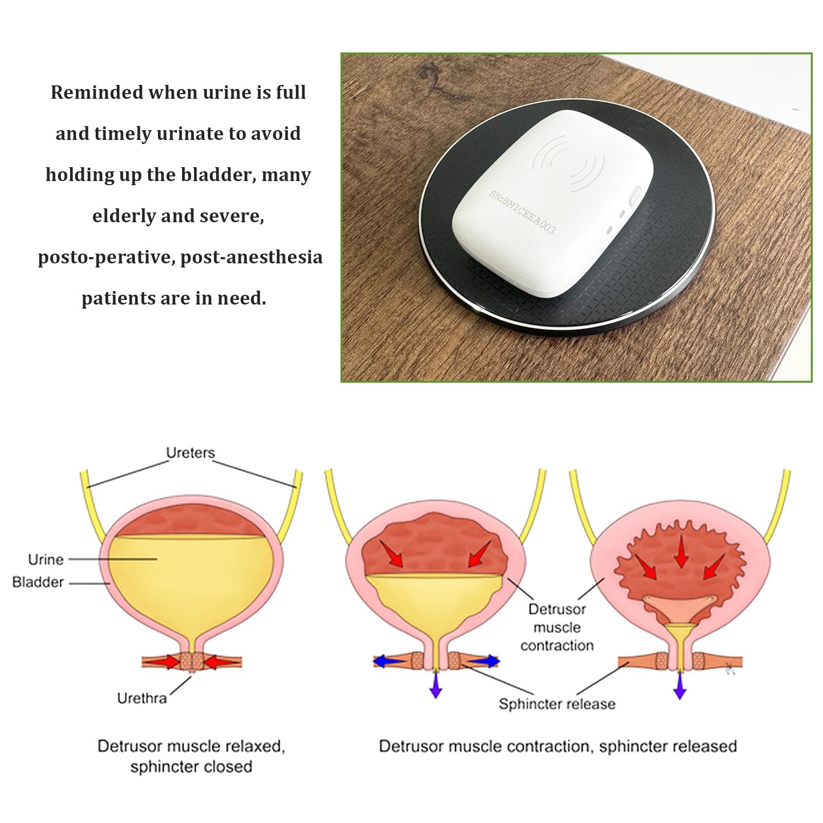 Scanner indossabile del volume dell'urina della vescica per incontinenza nefrostomia stomia forniture per la mete delle urine