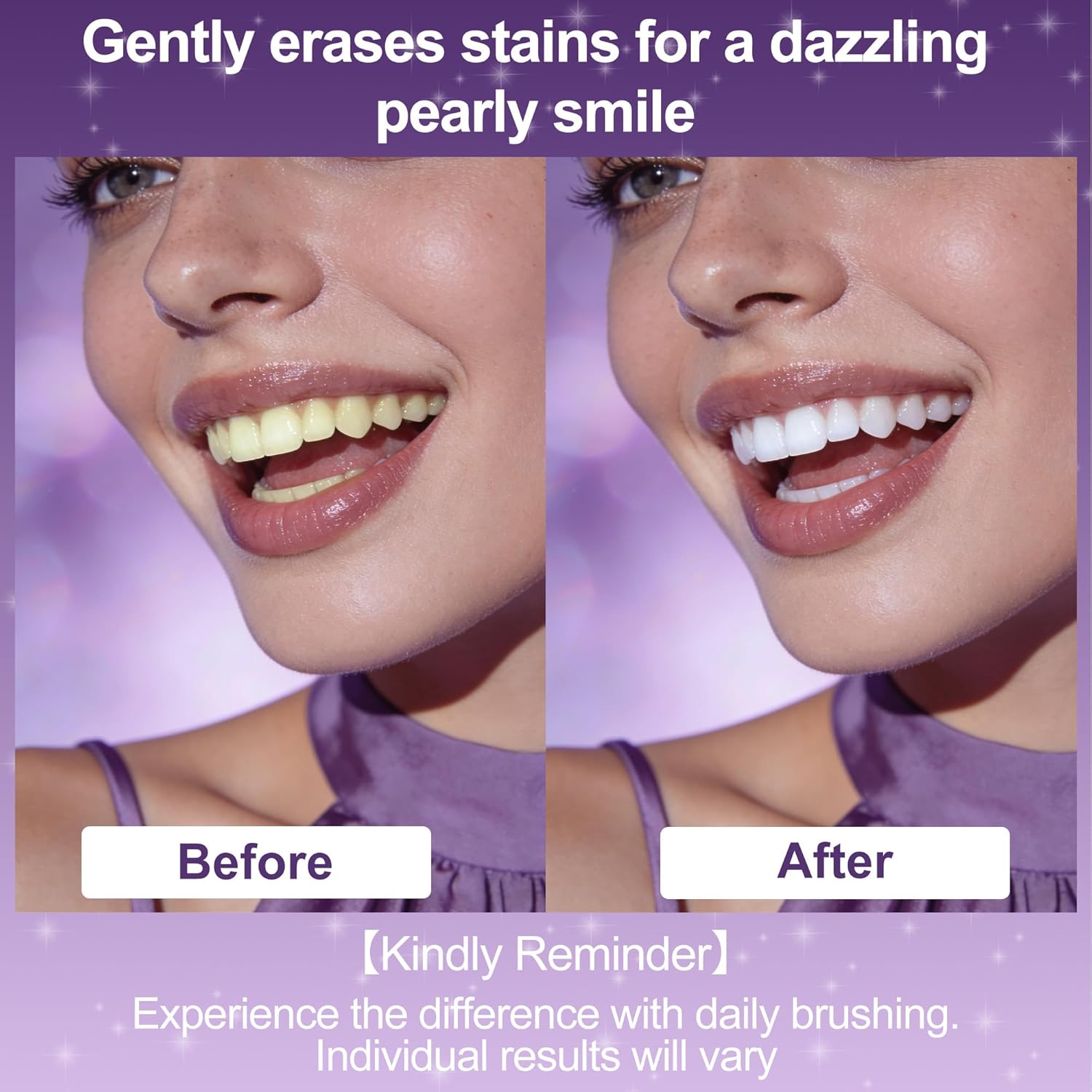 7-Pro Whitening Toothpaste with 7 Probiotics, Advanced Stain Removal Formula for Gum Health, Purple Burst Beads for Fresh Breath, Fluoride-Free & Enamel Safe (4 PCS)