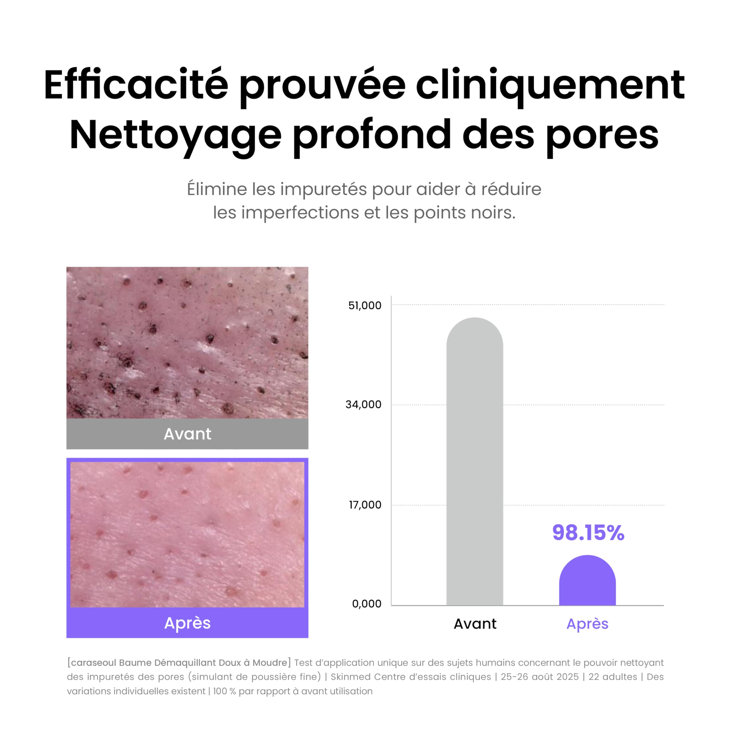 Baume Démaquillant Exfoliant Doux avec BHA & Bakuchiol, Huile Nettoyante Vegan 50ml