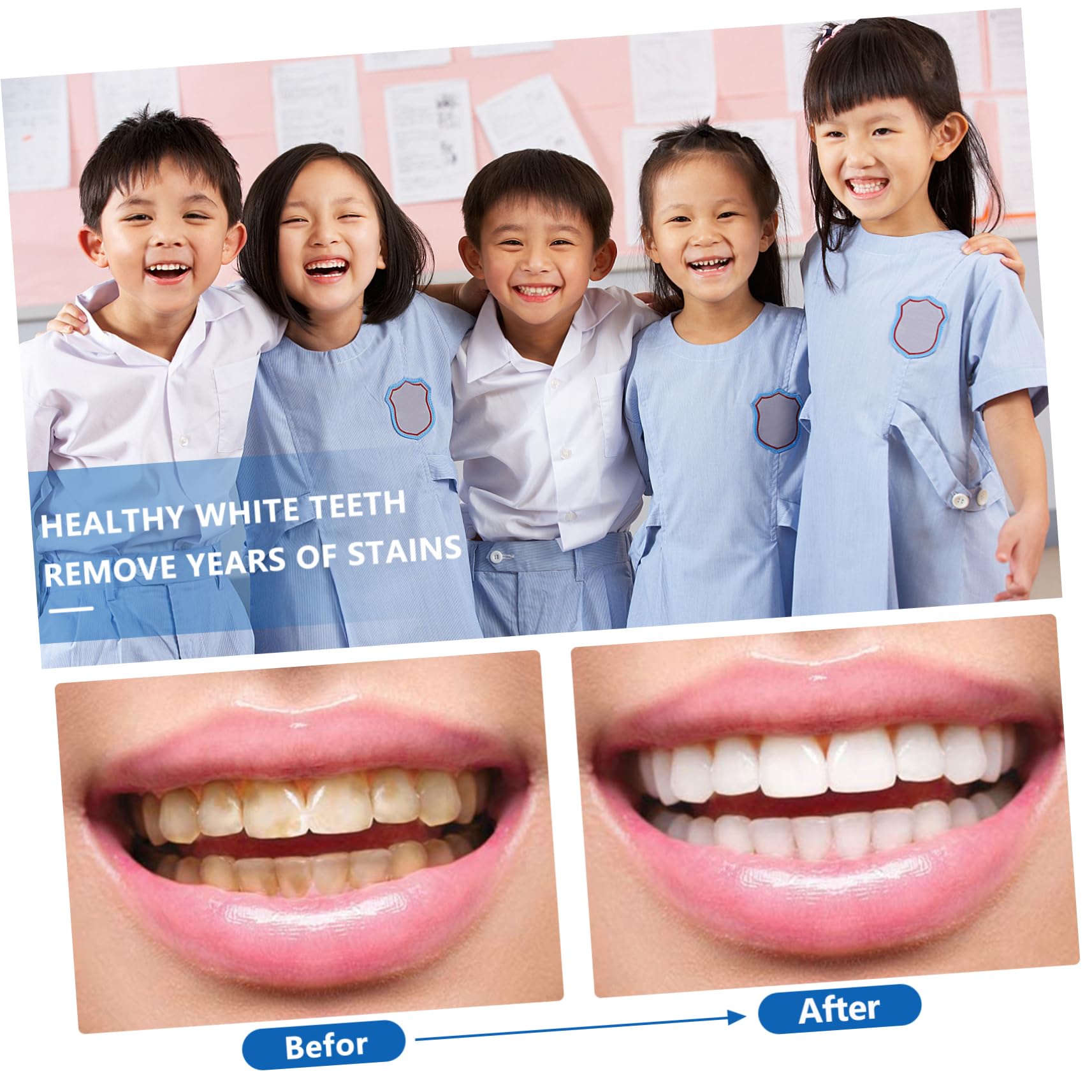 FRCOLOR 8 Piezas cepillo automático halitosis kinder cepillo infantil limpiador electrico bebe eléctrico familiar