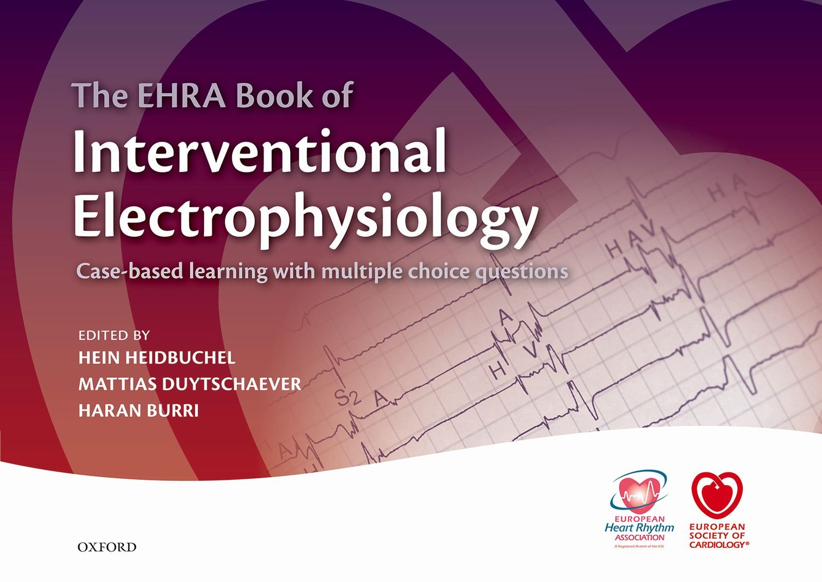 The EHRA Book of Interventional Electrophysiology: Case-based learning with multiple choice questions (The European Society of Cardiology Series) (English Edition)