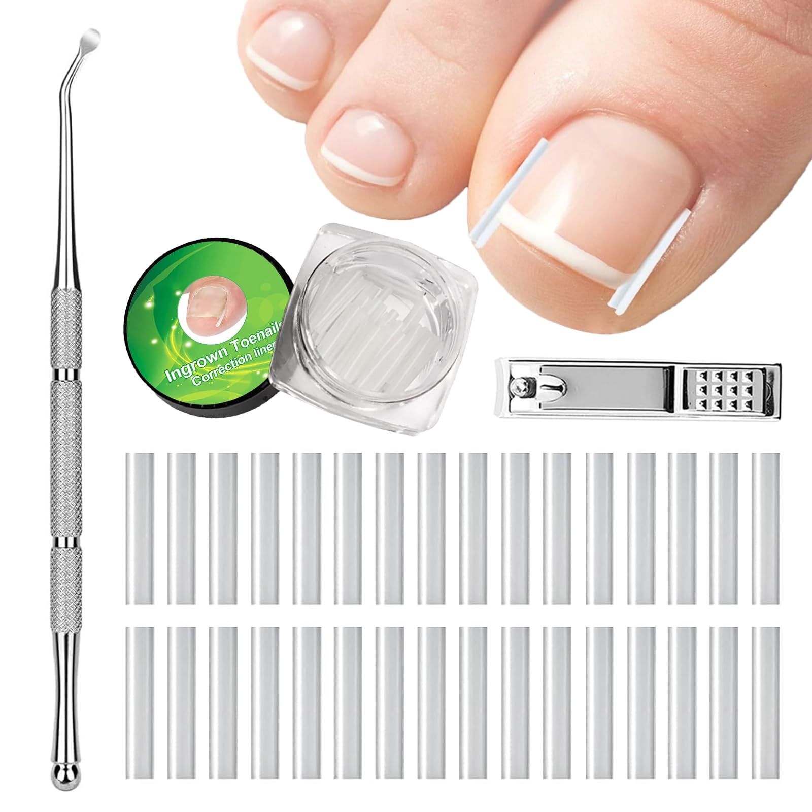 Set zur Korrektur eingewachsener Zehennägel, 62 Stück Schmerzfreie Zehennagelglättungsstreifen mit Zehennagelheber und Nagelklipper, einfaches Werkzeugse