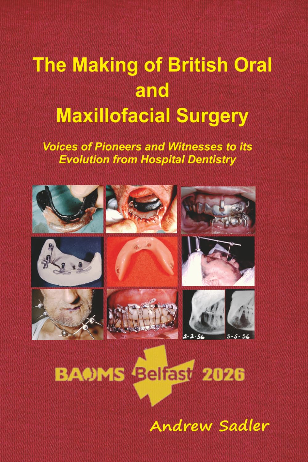 The Making of British Oral and Maxillofacial Surgery: Voices of Pioneers and Witnesses to its Evolution from Hospital Dentistry