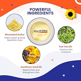 Human Mite Treatment Cream 2oz | Max-Strength 10x Sulfur Cream for Skin Mites, Bites, & Itching | Child & Adult Safe | Fast Relief for All Skin Types by Mite-Be-Gone