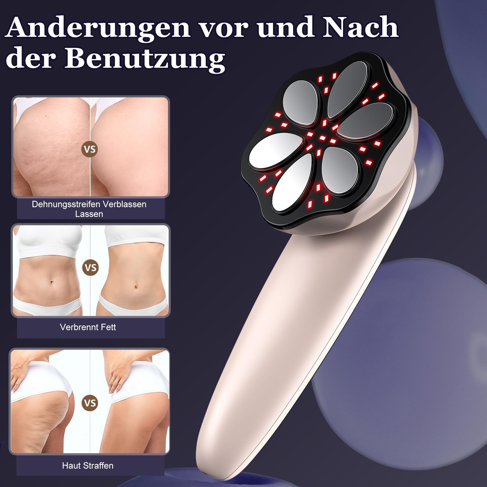 Cellulite Massagegerät, Anti Lipödem Handmassagegerät, Massage Anti Cellulite Mit 3 Modi, VerfüGt über 6 MassageköPfe mit GrößEren Bereichen für Bauch, Taille, Arme, Beine, Gesäß und Rückenmassagefe