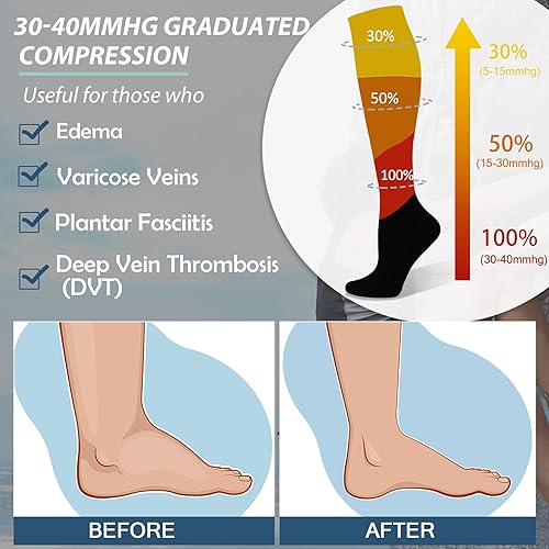 Miniatura 4 de FULLSOFT Calcetines de compresión graduados médicos de 30-40 mmHg para mujeres y hombres, calcetines de circulación hasta la rodilla, calcetines de