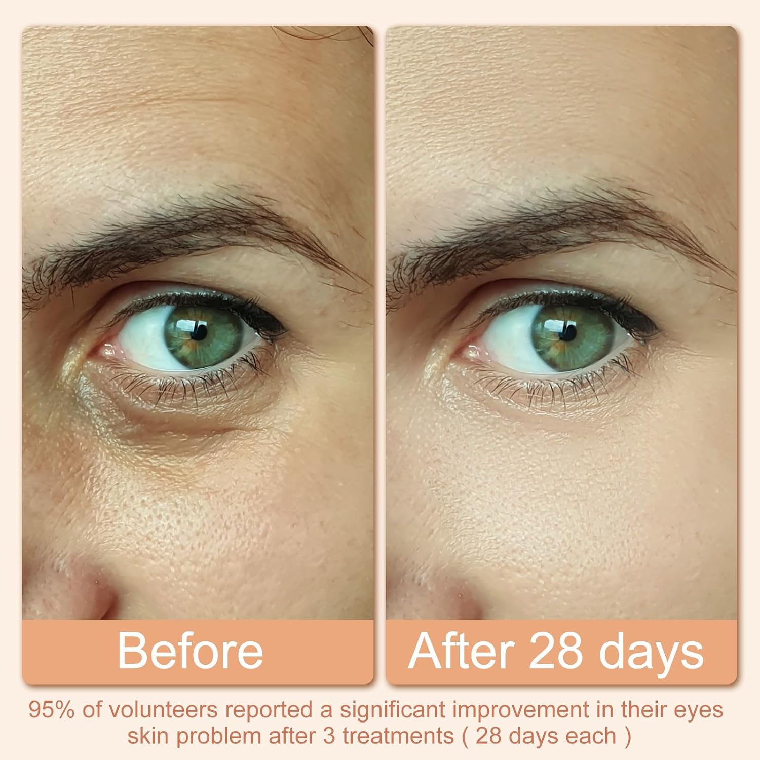 Red Light Therapy for Eyes, Under Eye Red Light Therapy, Eye Massager for Reducing Dark Circles and Puffiness,Smoothing Fine Lines - Image 3