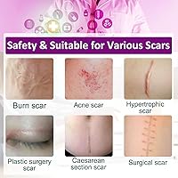 Vista 3 de Hojas de silicona para cicatrices (1.6 x 60 pulgadas, 1.5 M), cinta transparente para cicatrices, tiras de cicatrices de silicona, cicatrices