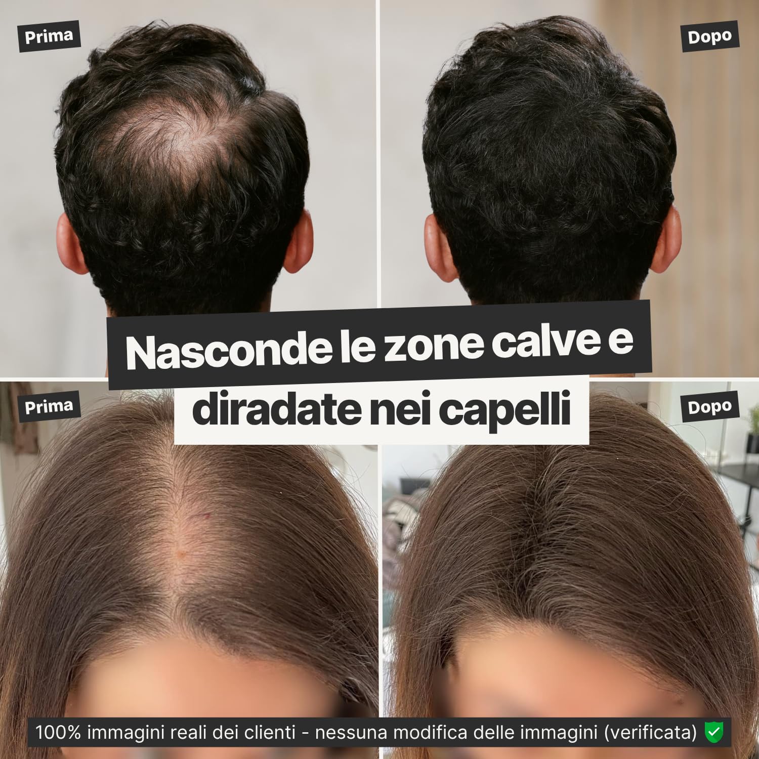 IMPERIO Fibre capelli - per l'infoltimento dei capelli per capelli più spessi e pieni in pochi secondi. Nasconde la caduta dei capelli nelle donne e negli uomini. 100% naturale. 26g (castano scuro)