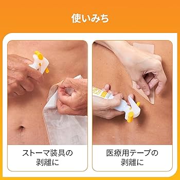 未開封新品 ストーマ・プロテクティブシール・リムーバー・皮膚被膜剤まとめて キャビロン皮膚用リムーバー スプレータイプ | ストーマ装具の