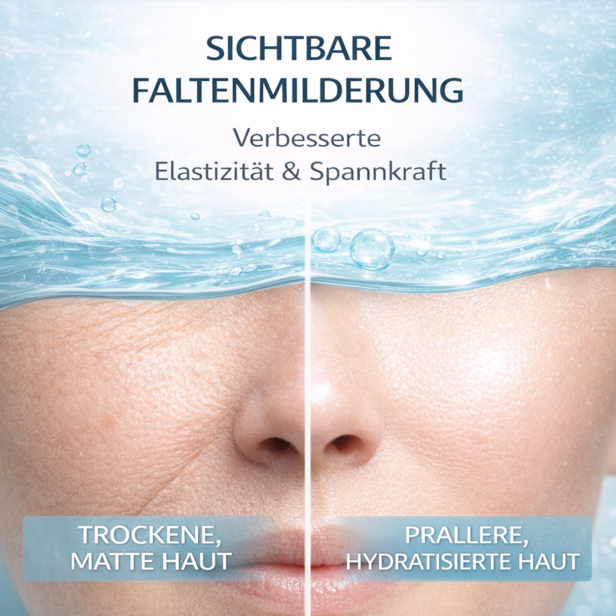 Matrixneedling Siero ialuronico 3,5% – 3 booster di acido ialuronico – Siero sterile Microneedling per Dermapen & Dermaroller – Siero ialuronico altamente concentrato contro rughe, cicatrici e