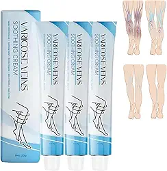 Tratamento Para Varizes Nas Pernas, Creme - Melhora A Circulação Sanguínea, Reduz O Peso (3 Unidades)