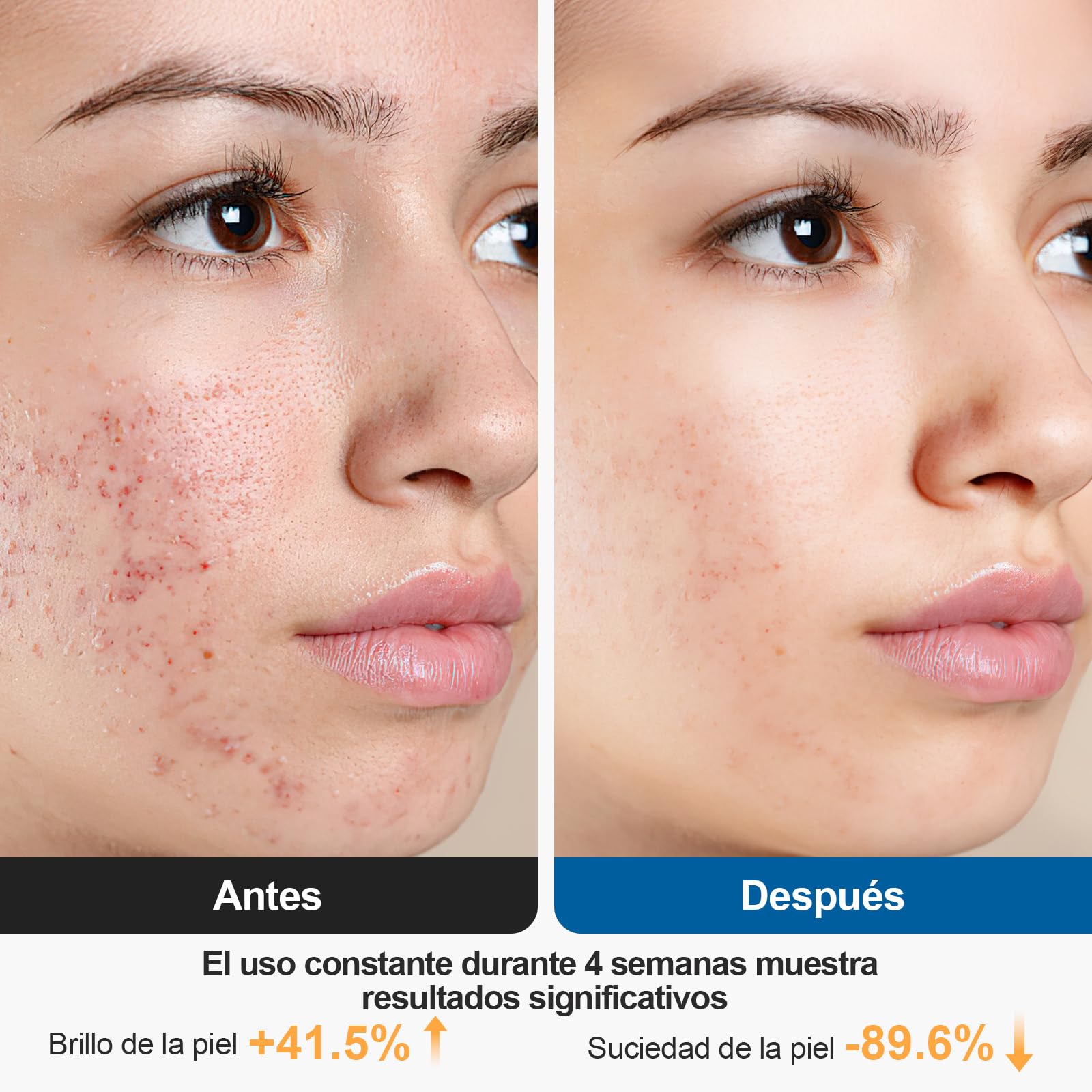 Limpiador Facial Electrico, 3 en 1 Cepillo de Limpieza Facial con 4 cabezales limpiadores Masajeador Facial Con EMS y Calefacción, Para Limpieza Profunda, EliminacióN de Acné y Puntos Negros