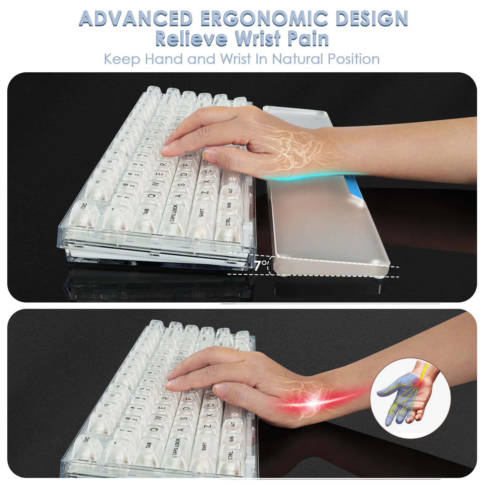 Poggiapolsi in acrilico per tastiera da gioco, poggiapolsi ergonomico trasparente con base antiscivolo, logo personalizzato in lega di alluminio per tastiera compatta 80% computer, ufficio, giochi per