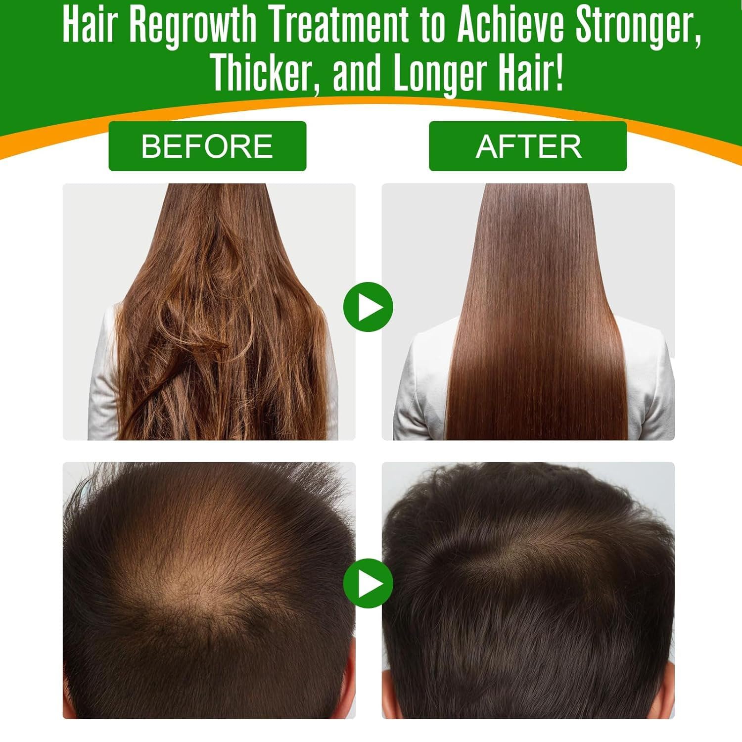 Batana Oil for Hair Growth & Skin Care, 100% Pure & Natural Batana Oil, Prevents Hair Loss, Repairs Damaged Hair & Skin - Image 2