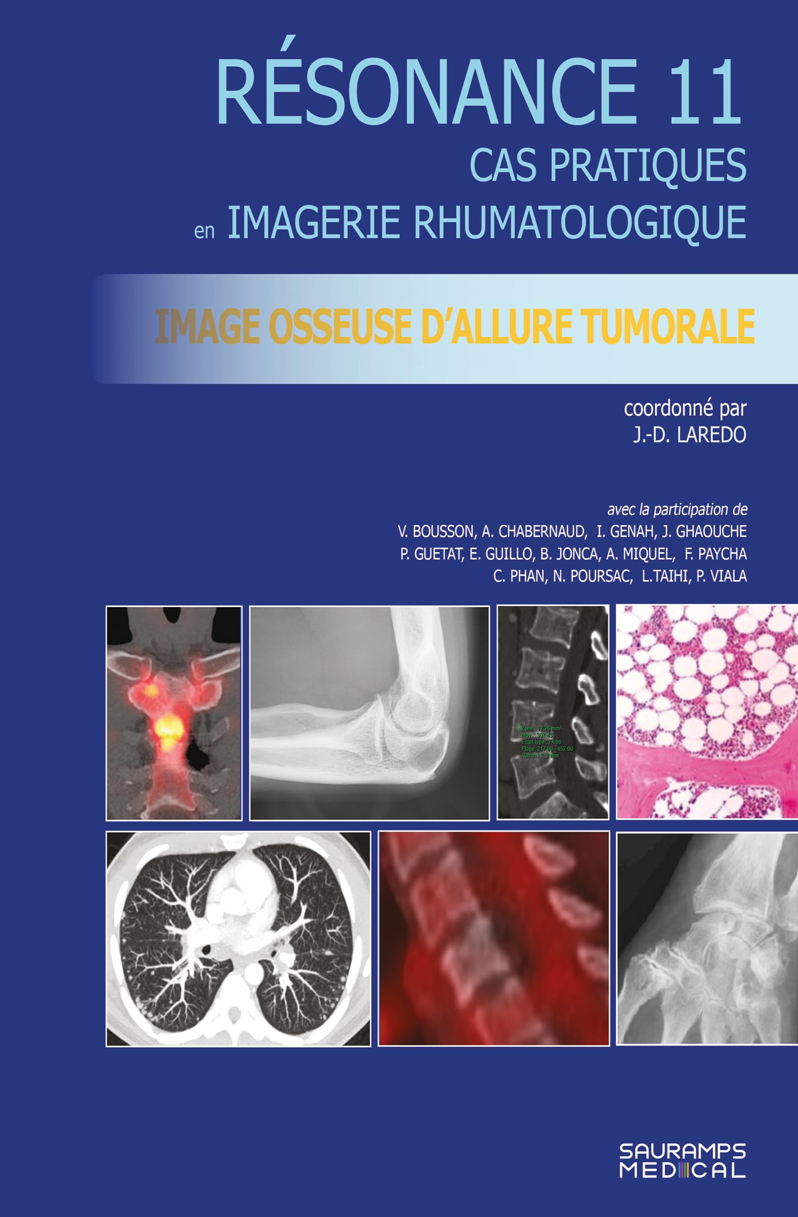 Imagerie osseuse d'allure tumorale: Cas pratiques en imagerie musculosquelettique