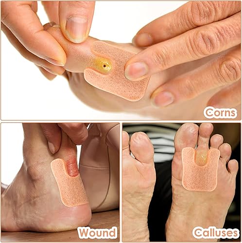 Miniatura 4 de Almohadillas de callo, 10 pares de cojines de fieltro suave en forma de U, cojines autoadhesivos para eliminar callos de maíz, almohadillas
