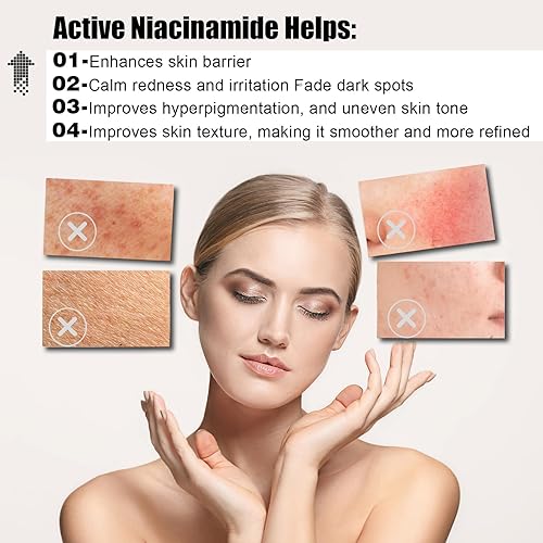 Miniatura 4 de Actualizado Eliminador de manchas oscuras para cara, suero brillante corrector de manchas oscuras con niacinamida retinol y vitamina C, removedor