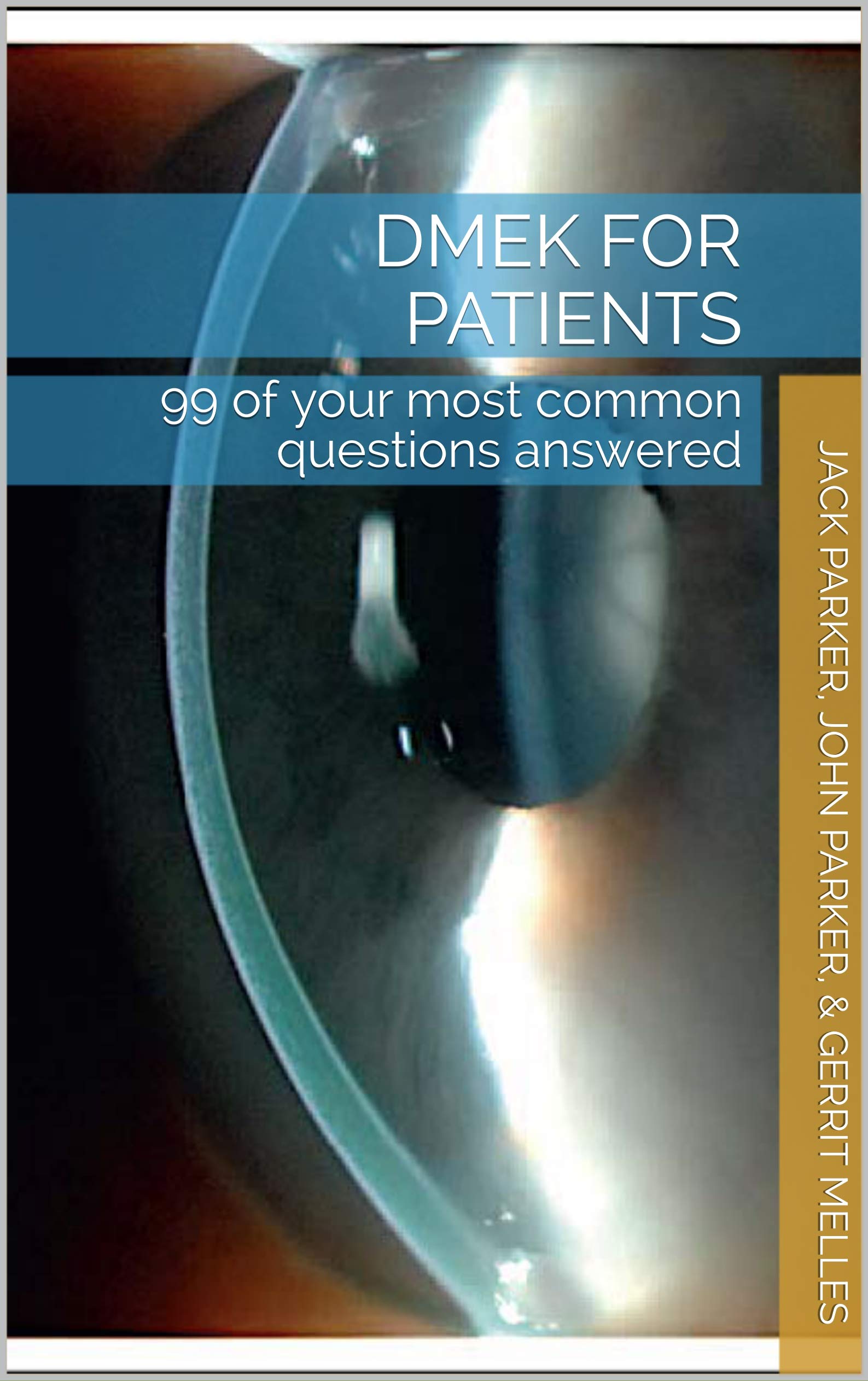 DMEK for patients: 99 of your most common questions answered