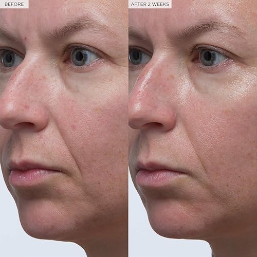 Miniatura 9 de Glow Recipe Suero hialurónico Plum Plump - Suero hidratante de ácido hialurónico y aceite de ciruela para líneas finas y arrugas - Vitamina B5