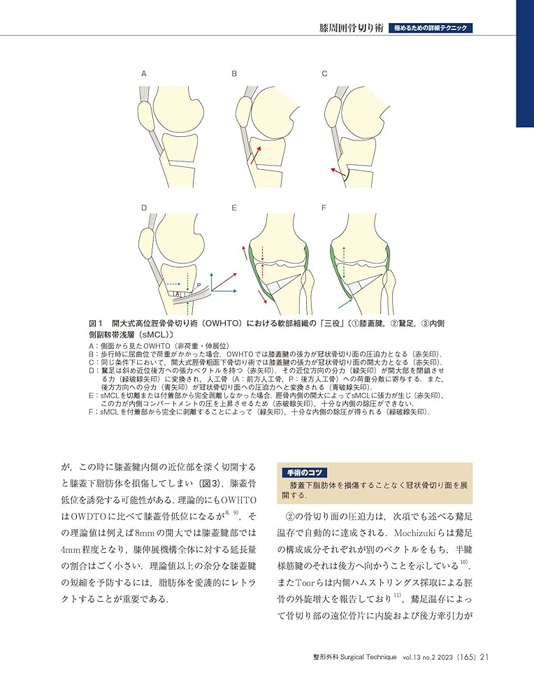 整形外科サージカルテクニック 2023年2号 膝周囲骨切り術（第13