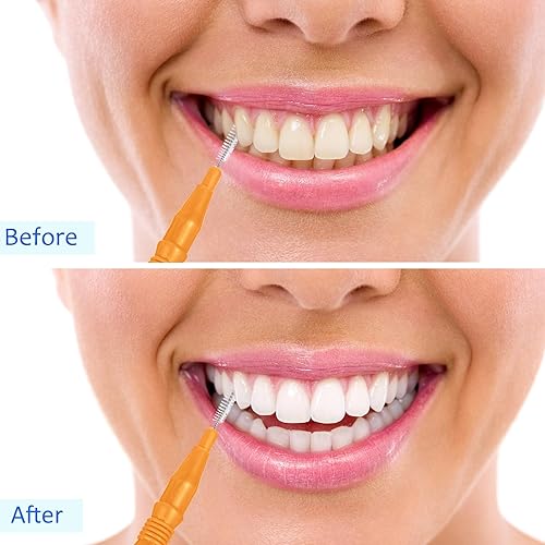 Miniatura 21 de BBTO 100 piezas de llaves de cepillo dental para limpiador interdental, palillo de dientes, cabezal de hilo dental, limpiador oral de palillos Rojo