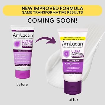 AmLactin Ultra Smoothing - كريم علاجي لليدين الجافة المتشققة - مقشر ومرطب بدون فرك يحتوي على 15% حمض اللاكتيك AHA، 4.9 أونصة (قد تختلف العبوة)