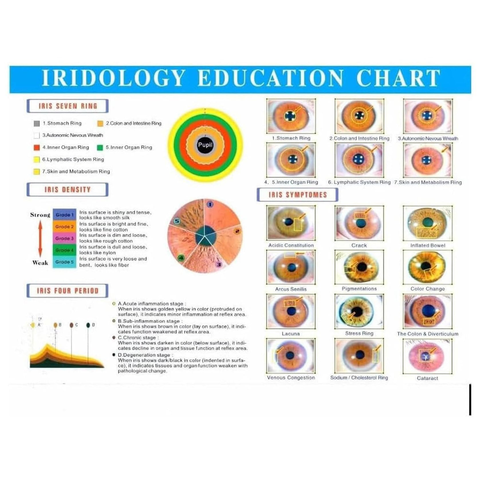 ZHIXUMM Analyseur D'Iris pour CaméRa Iridologique, Interface USB 2.0, Iriscope avec Objectif Iris 30x Et Logiciel D'Analyse, CaméRa D'Analyse Iridologique, 12 Millions De Pixels