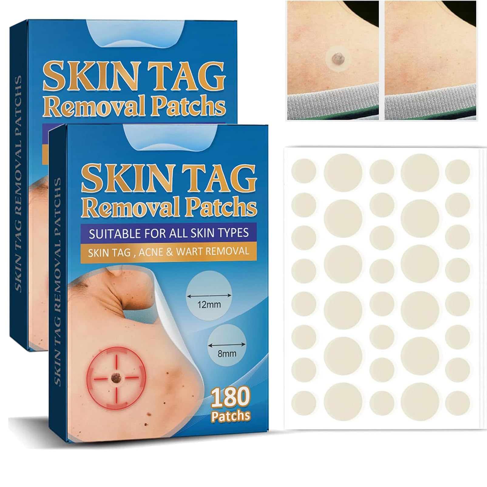 360pcs Skin-Tag-Removal丨Stickers Patches丨Tag Remover丨Skin Tag Patches & Mole Remover Patches丨Skin Tag Remover & Tag Removal Patches,Acne Patches,Spot Patches for Face,Finger,Arm,Leg (2)