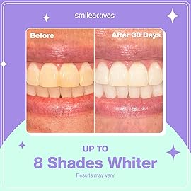 Smileactives Teeth Whitening Kit, Complete at Home Teeth Whitening Treatment, Travel Size Tooth Whitening, Stain Remover for White Teeth, Contains Clinical-Grade Hydrogen Peroxide, 60 Day Kit
