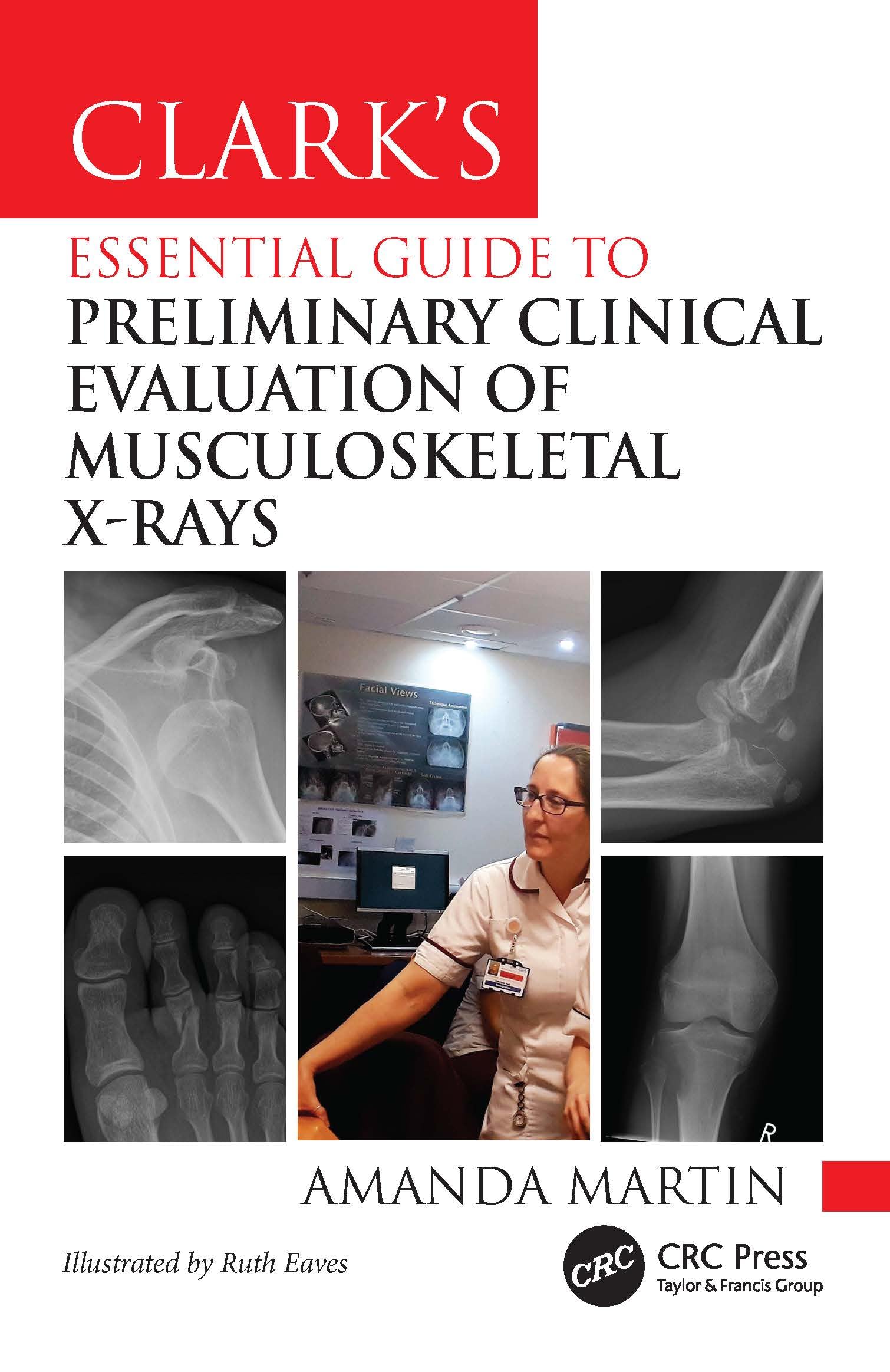 Clark’s Essential Guide to Preliminary Clinical Evaluation of Musculoskeletal X-rays: Evaluating and Commenting on Images (Clark's Companion Essential Guides)