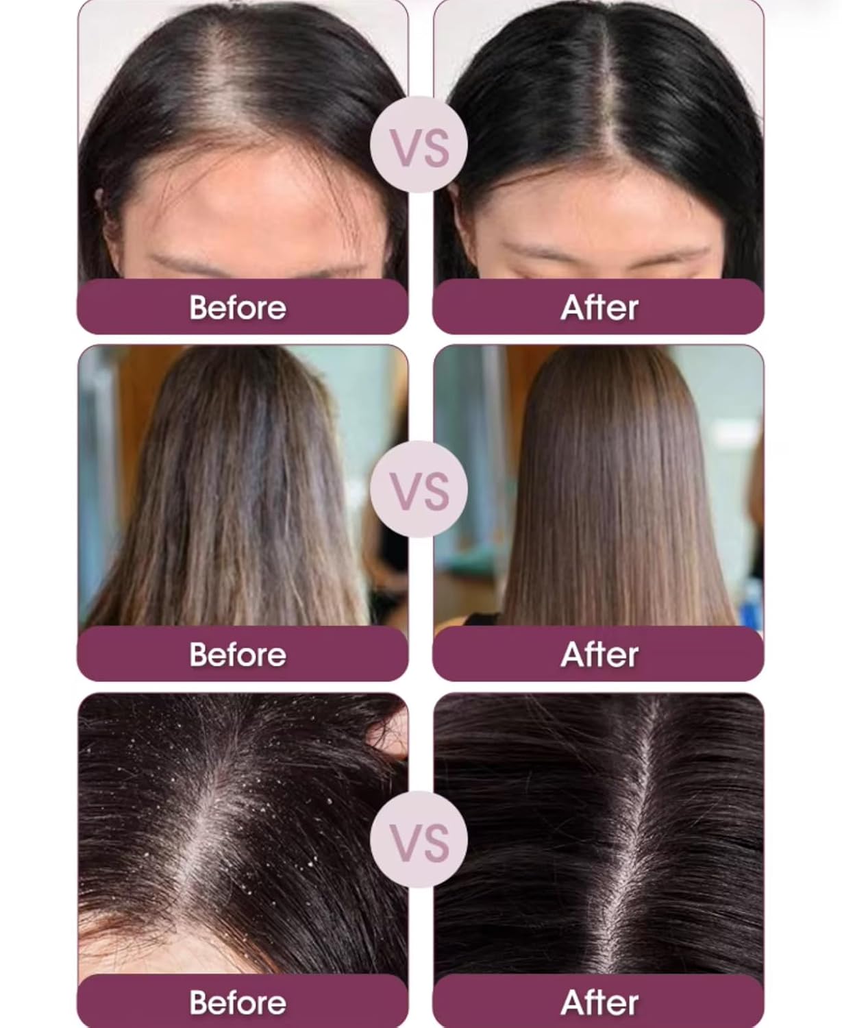 Red Onion Anti-Hair Loss Shampoo, Conditioner and Hair Mask Set, Natural Organic Herbal Formula with Black Seed Oil, 16.9 fl oz for all hair types, prevents hair loss.