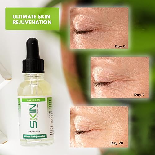 Miniatura 4 de Skinapeel Sérum de colágeno 1.0 fl oz 1 fl. oz Cuidado de la piel clínico Londres fabricado en Reino Unido - Uso con rodillo Derma Micro Aguja y