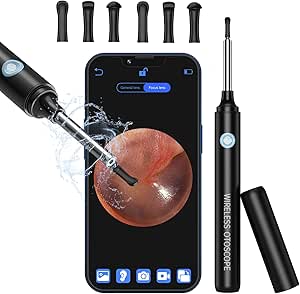 Ohrenschmalz Entferner Mit LED Licht - Elektrisch & Wasserdicht