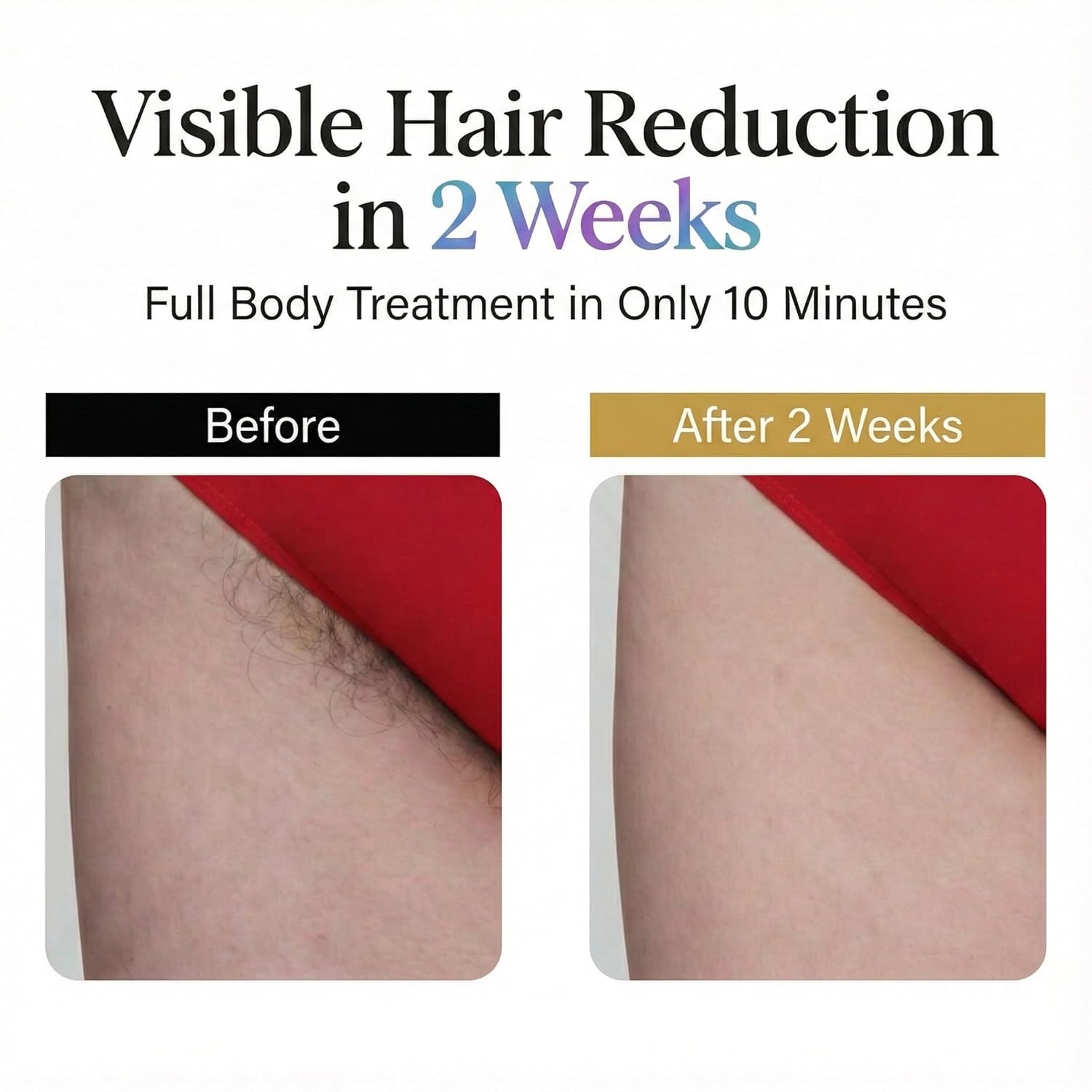 IPL Laser Hair Removal Device for Women & Men, Nex-Gen At Home Laser Hair Removal with 45°F Dual Sapphire Ice Cooling for Painless & Long Lasting Results, Full Body Lazer Hair Removal for Women - Image 3