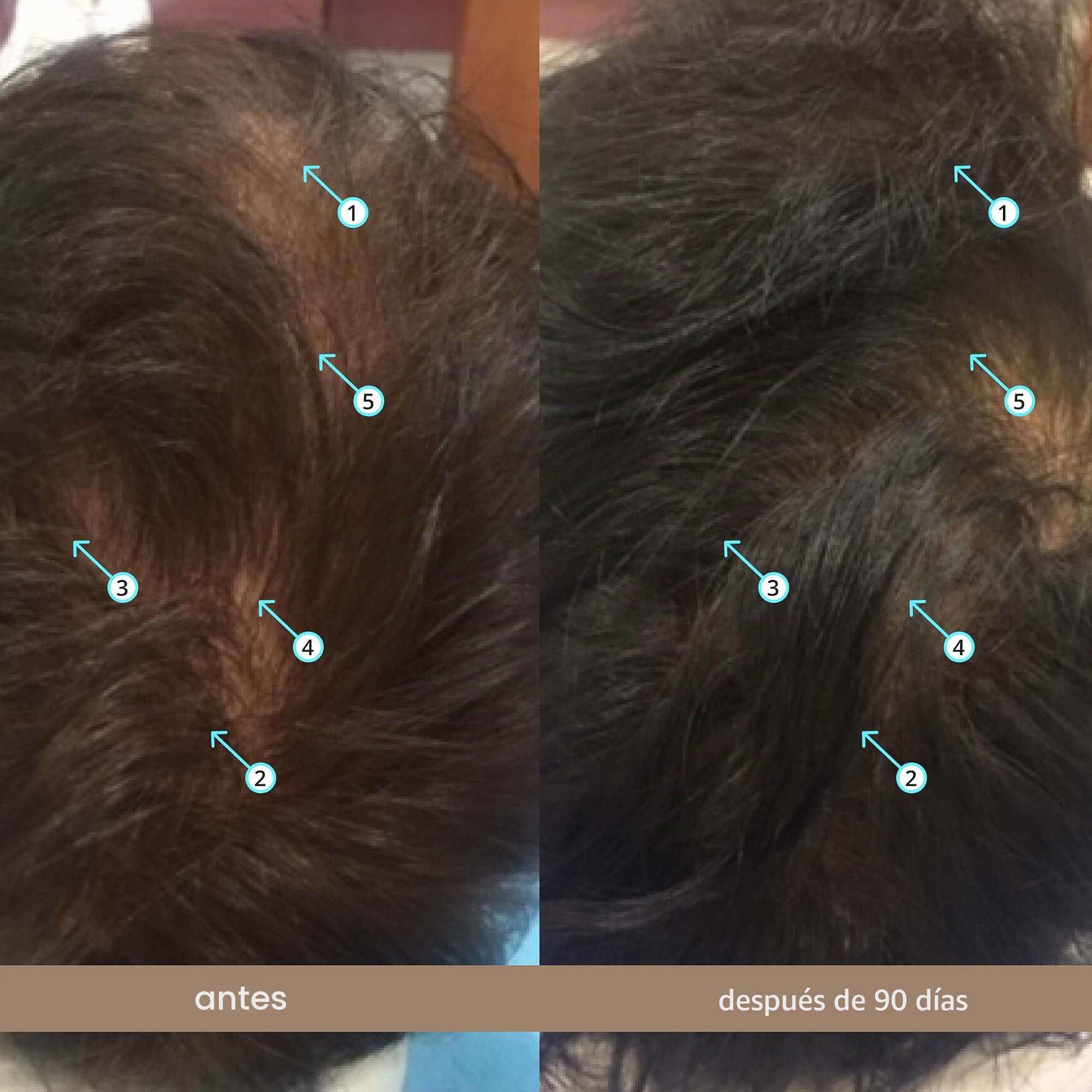 Spectral.DNC-N Tratamiento anticaída de DS Laboratories, Ayuda a reducir la caída del cabello y estimula el crecimiento del cabello, Fórmula con Nanoxidil 5% (60ml)
