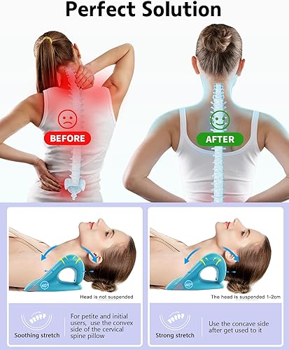 Miniatura 2 de Estirador de cuello para alivio del cuello - Relajante de cuello y hombros, almohada cervical para aliviar la fatiga y el dolor de cuello y hombros,