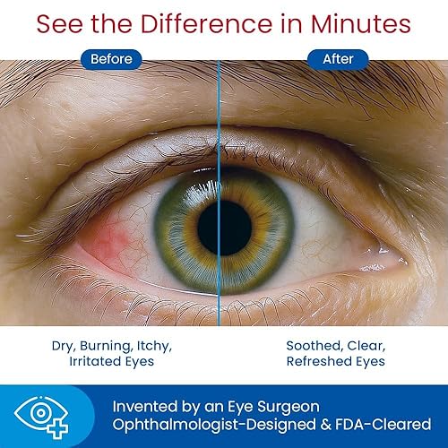 Miniatura 8 de Eye-press - Toallitas autocalentables para ojos y tapas, tratamiento de orzos, ojos secos, calazia, blefaritis y alivio posterior a la cirugía