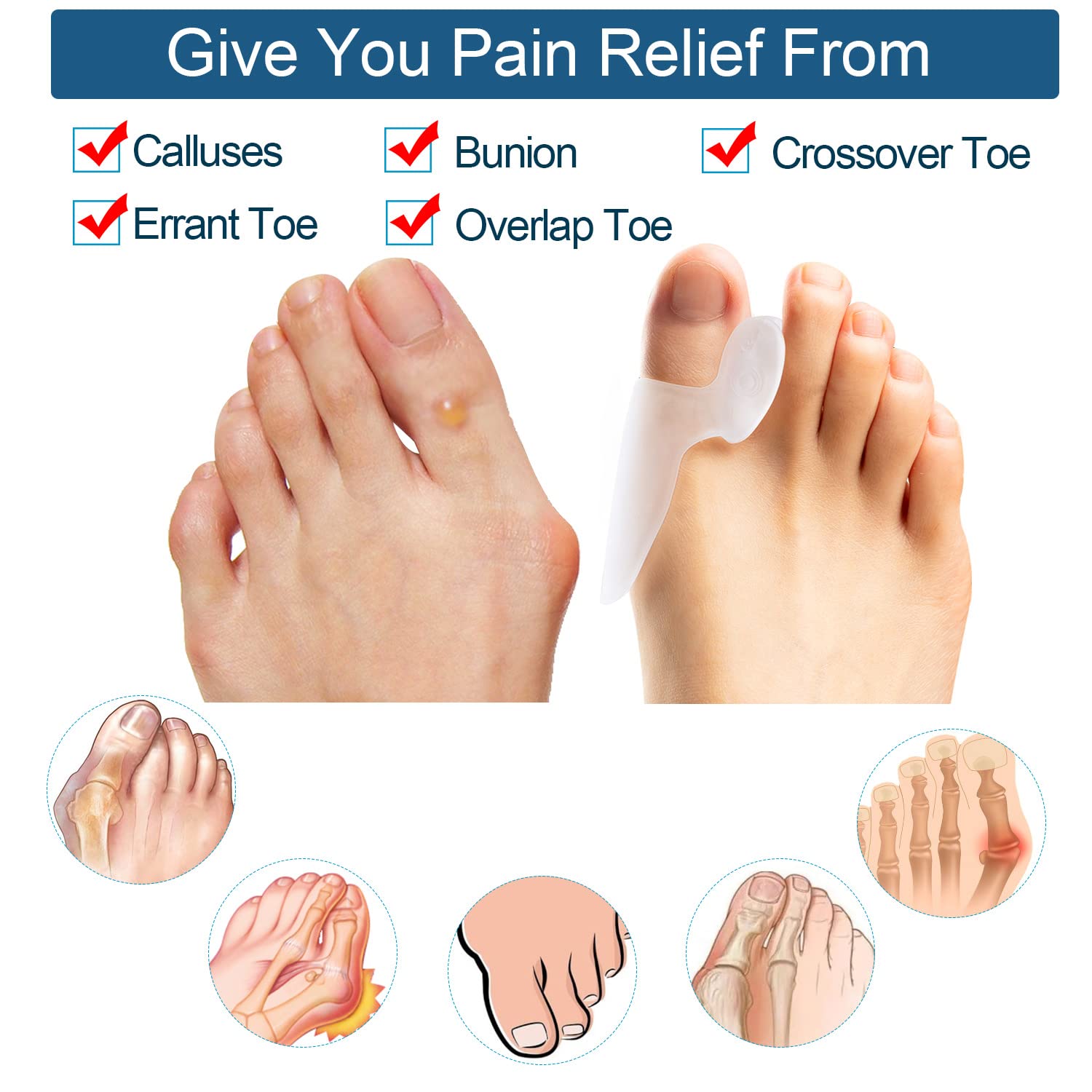 Promifun Gel Bunion Protector Shield, confezione da 10 cuscinetti e imbottiture per alluce valgo, protezione per alluce valgo, allevia il dolore ai piedi causato da attrito, sfregamento e pressione