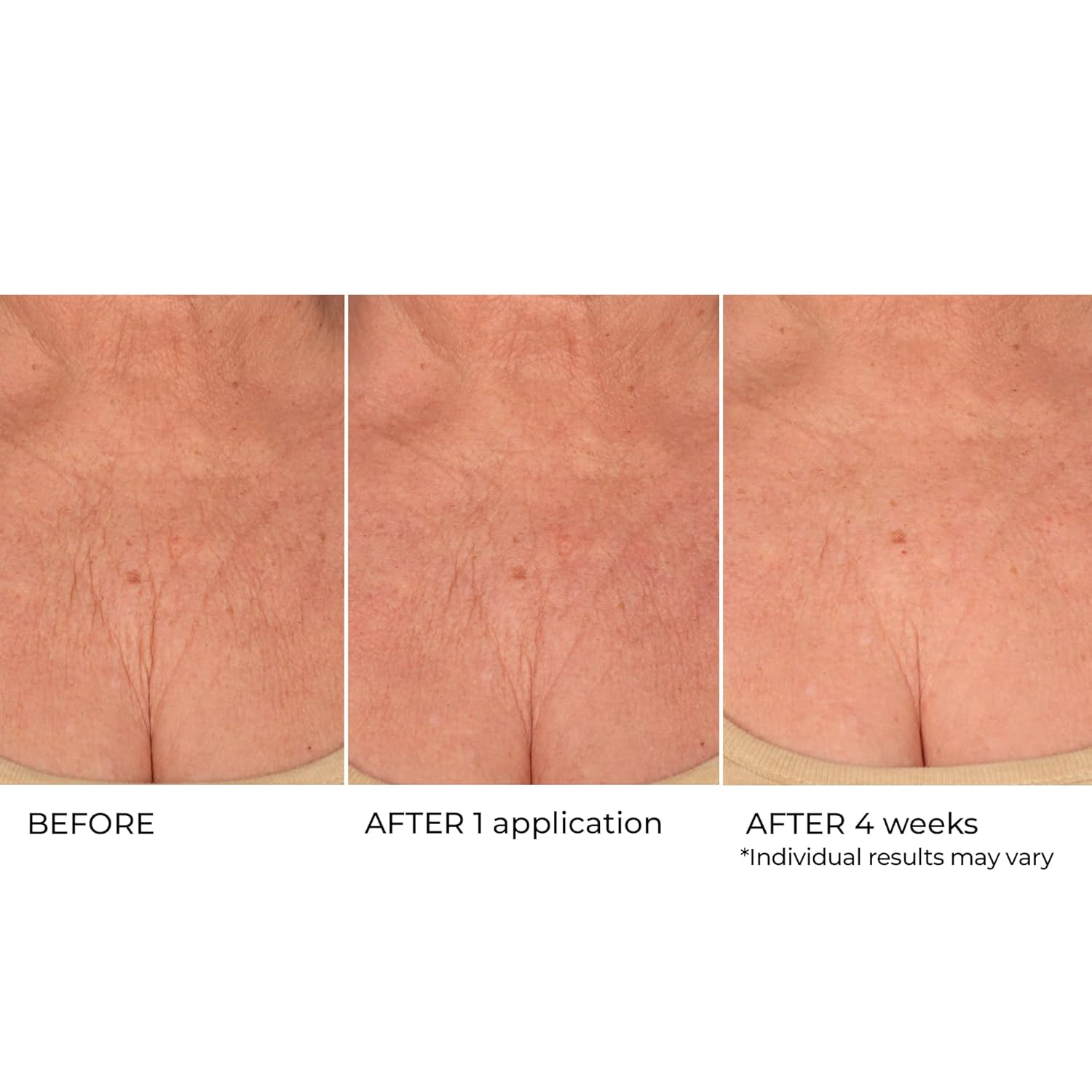 NassifMD Age Defying Neck & Décolleté Serum, Lifts and Firms Thin Neck Skin, Hydrates and Smooths - Image 3