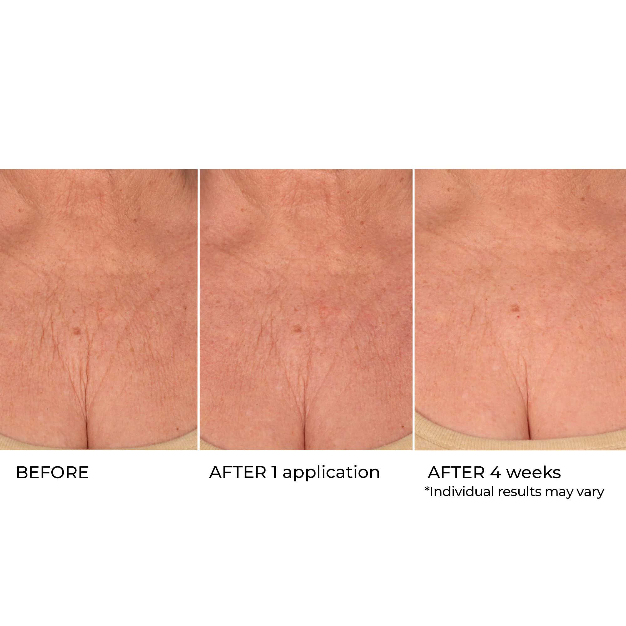 NassifMD Age Defying Neck & Décolleté Serum, Lifts and Firms Thin Neck Skin, Hydrates and Smooths